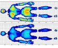 XSENSOR pressure maps: top shows red and orange high-pressure zones, bottom shows even blue weight distribution